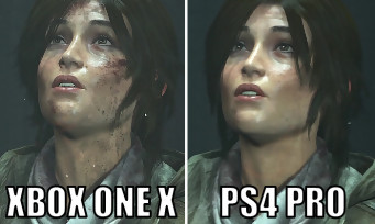 Rise of the Tomb Raider : un comparatif Xbox One X / PS4 Pro à l'avantage de Microsoft. Alors que la sortie de la Xbox One X approche rapidement